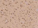 HCN1 Polyclonal Antibody