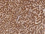 HDLBP Antibody in Immunohistochemistry (Paraffin) (IHC (P))