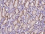 HIBCH Polyclonal Antibody