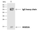HIGD2A Antibody in Immunoprecipitation (IP)