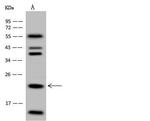 HINT3 Antibody in Western Blot (WB)