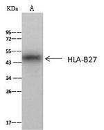 HLA-B27 Antibody in Immunoprecipitation (IP)