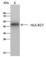 HLA-B27 Antibody in Immunoprecipitation (IP)