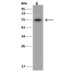 HSPA14 Antibody in Western Blot (WB)