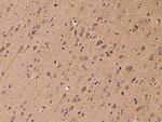 HSPA2 Polyclonal Antibody