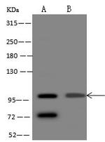 HSPA4 Polyclonal Antibody