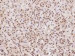 HTATSF1 Antibody in Immunohistochemistry (Paraffin) (IHC (P))