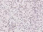 HTATSF1 Antibody in Immunohistochemistry (Paraffin) (IHC (P))