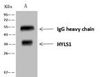 HYLS1 Antibody in Immunoprecipitation (IP)