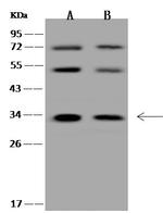 HYLS1 Antibody in Western Blot (WB)