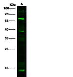 ICAM-1 Antibody in Western Blot (WB)
