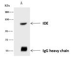 IDE Antibody in Immunoprecipitation (IP)