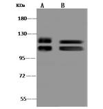 IDE Antibody in Western Blot (WB)