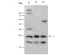 IL1F6 Polyclonal Antibody