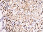 ILKAP Antibody in Immunohistochemistry (Paraffin) (IHC (P))