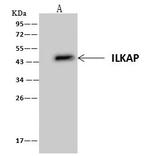 ILKAP Antibody in Immunoprecipitation (IP)