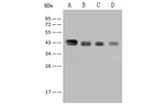 ILKAP Antibody in Western Blot (WB)