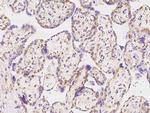 IMPDH2 Polyclonal Antibody
