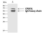 CPSF3L Antibody in Immunoprecipitation (IP)