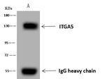ITGA5 Antibody in Immunoprecipitation (IP)