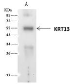 Cytokeratin 13 Antibody in Immunoprecipitation (IP)