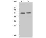 Cytokeratin 13 Polyclonal Antibody