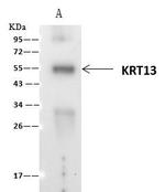 Cytokeratin 13 Antibody in Immunoprecipitation (IP)