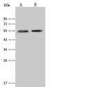 Cytokeratin 13 Antibody in Western Blot (WB)