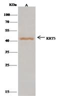 Cytokeratin 5 Antibody in Immunoprecipitation (IP)