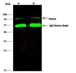 Cytokeratin 5 Antibody in Immunoprecipitation (IP)