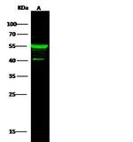 Cytokeratin 5 Antibody in Western Blot (WB)