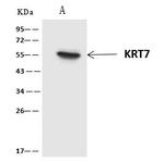 Cytokeratin 7 Antibody in Immunoprecipitation (IP)