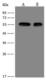 Cytokeratin 7 Antibody in Western Blot (WB)