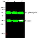 LDHA Antibody in Immunoprecipitation (IP)