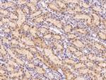 Leptin Receptor Polyclonal Antibody