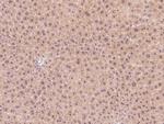 Leptin Receptor Polyclonal Antibody
