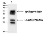 Galectin 3 Antibody in Immunoprecipitation (IP)