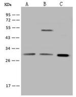 Galectin 3 Polyclonal Antibody