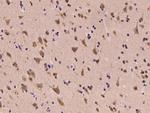 LIAS Polyclonal Antibody