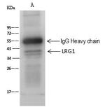 LRG1 Antibody in Immunoprecipitation (IP)