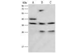 LRG1 Polyclonal Antibody