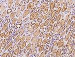 LYPLAL1 Polyclonal Antibody
