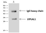 LYPLAL1 Antibody in Immunoprecipitation (IP)