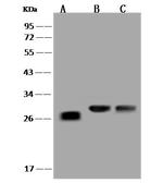 LYPLAL1 Antibody in Western Blot (WB)