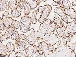 MAGEA10 Polyclonal Antibody