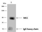 MCC Antibody in Immunoprecipitation (IP)