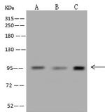 MCC Polyclonal Antibody