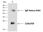 MCEMP1 Antibody in Immunoprecipitation (IP)