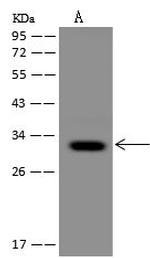 MCU Polyclonal Antibody