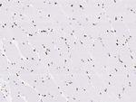MEF2D Antibody in Immunohistochemistry (Paraffin) (IHC (P))